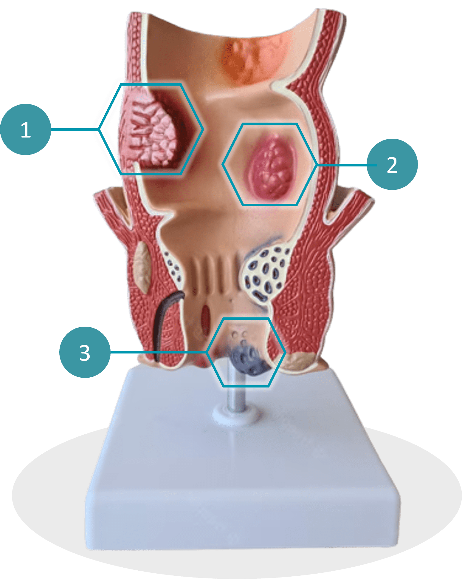 Intestino 3D2
